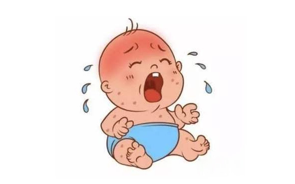 科普课堂 | 湿疹反反复复，当心特应性皮炎惹的祸！